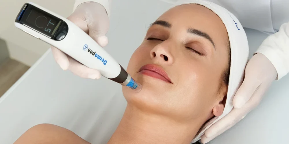 image_dermapen_4_refresh_helps_you_succeed_horizontal