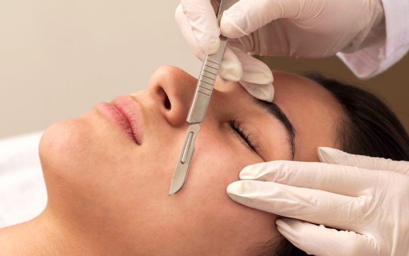 procedure-dermaplaning